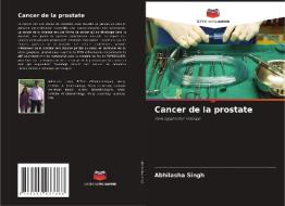 Cancer de la prostate di Abhilasha Singh edito da Editions Notre Savoir