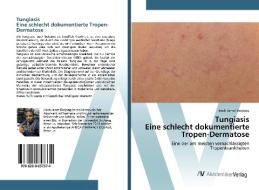 TungiasisEine schlecht dokumentierte Tropen-Dermatose di Jinoh Jamet Banjong edito da AV Akademikerverlag