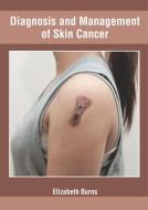 Diagnosis and Management of Skin Cancer edito da FOSTER ACADEMICS