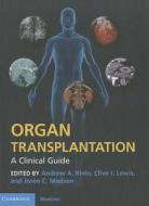 Organ Transplantation di Andrew A. Klein edito da Cambridge University Press