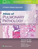 Atlas of Pulmonary Pathology di Jennifer Wer edito da LIPPINCOTT RAVEN