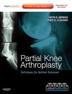 Partial Knee Arthroplasty di Keith R. Berend, Fred D. Cushner edito da Elsevier - Health Sciences Division