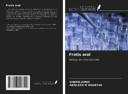 Frotis oral di Sherin James, Akhilesh M Wodeyar edito da Ediciones Nuestro Conocimiento