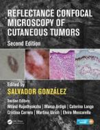 Reflectance Confocal Microscopy Of Cutaneous Tumors edito da Taylor & Francis Inc