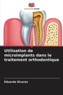 Utilisation de microimplants dans le traitement orthodontique di Eduardo Álvarez edito da Editions Notre Savoir