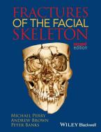 Fractures of the Facial Skeleton di Michael Perry edito da Wiley-Blackwell