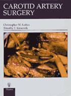 Carotid Artery Surgery di Christopher M. Loftus, Timothy F. Kresowik edito da THIEME MEDICAL PUBL INC