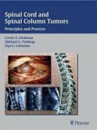 Spinal Cord And Spinal Column Tumors edito da Thieme Publishing Group