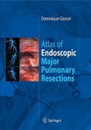 Atlas Of Endoscopic Major Pulmonary Resections di Dominique Gossot edito da Springer Editions