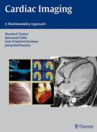 Cardiac Imaging di Manfred Thelen, Karl-Friedrich Kreitner, Raimund Erbel, Joerg Barkhausen edito da Thieme Publishing Group