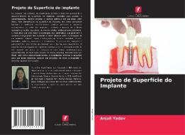 Projeto de Superfície do Implante di Anjali Yadav edito da Edições Nosso Conhecimento