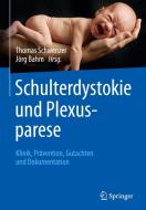Schulterdystokie und Plexusparese edito da Springer-Verlag GmbH