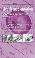 Liver Transplantation: Challenging Controversies and Topics di Gregory T. Everson edito da SPRINGER NATURE