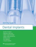 ADA Flip Guide to Dental Implants di American Dental Association edito da AMER DENTAL ASSN
