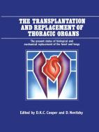 The Transplantation and Replacement of Thoracic Organs edito da Springer Netherlands