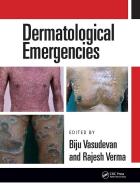 Dermatological Emergencies di VASUDEVAN edito da Taylor & Francis Inc