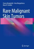 Rare Malignant Skin Tumors di Franco Rongioletti, Irina Margaritescu, Bruce R. Smoller edito da SPRINGER NATURE