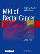 Mri Of Rectal Cancer di Mathias Langer, Arnd-Oliver Schafer edito da Springer-verlag Berlin And Heidelberg Gmbh & Co. Kg