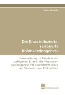 Die K-ras induzierte, serratierte Kolonkarzinogenese di Dr. Moritz Bennecke edito da Südwestdeutscher Verlag für Hochschulschriften AG  Co. KG