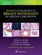 Rosen's Diagnosis Of Breast Pathology By Needle Core Biopsy di Syed A. Hoda, Raza S. Hoda, Elaine Zhong edito da Wolters Kluwer Health