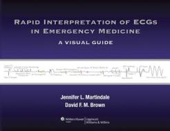 Rapid Interpretation Of Ecgs In Emergency Medicine di Jennifer L. Martindale, David F. M. Brown edito da Lippincott Williams And Wilkins