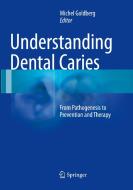 Understanding Dental Caries edito da Springer International Publishing Ag
