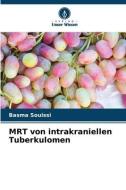 MRT von intrakraniellen Tuberkulomen di Basma Souissi edito da Verlag Unser Wissen
