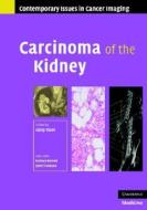 Carcinoma of the Kidney di Uday Patel edito da Cambridge University Press