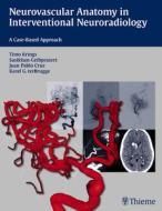 Neurovascular Anatomy in Interventional Neuroradiology: A Case-Based Approach di Timo Krings, Sasikhan Geibprasert, Karel Ter Brugge edito da THIEME MEDICAL PUBL INC
