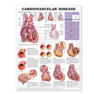 Cardiovascular Disease Anatomical Chart edito da Anatomical Chart Co.