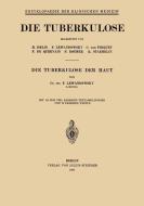 Die Tuberkulose der Haut di F. Lewandowsky edito da Springer Berlin Heidelberg