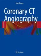 Coronary CT Angiography di Marc Dewey edito da Springer-Verlag GmbH