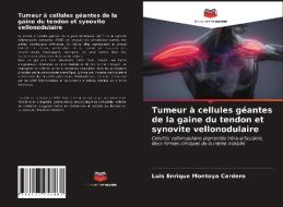 Tumeur à cellules géantes de la gaine du tendon et synovite vellonodulaire di Luis Enrique Montoya Cardero edito da Editions Notre Savoir