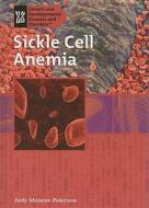 Sickle Cell Anemia di Judy Monroe Peterson edito da Rosen Publishing Group
