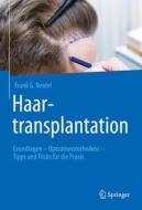 Haartransplantation di Frank G. Neidel edito da Springer-Verlag GmbH