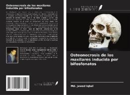 Osteonecrosis de los maxilares inducida por bifosfonatos di Md. Jawed Iqbal edito da Ediciones Nuestro Conocimiento
