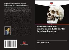Ostéonécrose des mâchoires induite par les bisphosphonates di Md. Jawed Iqbal edito da Editions Notre Savoir