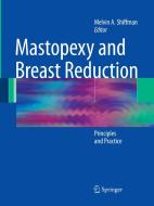 Mastopexy and Breast Reduction edito da Springer Berlin Heidelberg