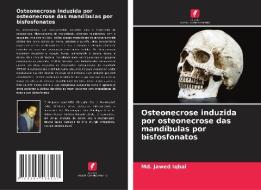 Osteonecrose induzida por osteonecrose das mandíbulas por bisfosfonatos di Md. Jawed Iqbal edito da Edições Nosso Conhecimento