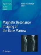 Magnetic Resonance Imaging Of The Bone Marrow edito da Springer-verlag Berlin And Heidelberg Gmbh & Co. Kg