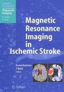 Magnetic Resonance Imaging In Ischemic Stroke edito da Springer-verlag Berlin And Heidelberg Gmbh & Co. Kg