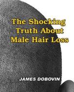 The Shocking Truth about Male Hair Loss: Secrets You Need to Know about Losing Hair So You Can Stop from Going Bald di James Dobovin edito da Createspace