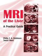 MRI of the Liver di Philip J. A. (St James University Hospital Robinson, Janice (St James University Hospital Ward edito da Taylor & Francis Inc