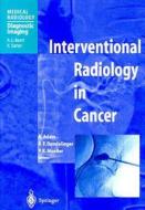 Interventional Radiology in Cancer di Adams, A. Adams, Dondelinger R F edito da Springer Berlin Heidelberg
