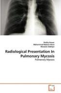 Radiological Presentation In Pulmonary Mycosis di Shafiq Anwar, Mohammad Mohsin Khan, Mustafa Siddiqui edito da VDM Verlag