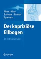 Der Kapriziose Ellbogen edito da Springer Berlin Heidelberg