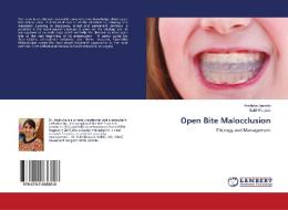Open Bite Malocclusion di Anshuka Jasrotia, Sahil Khajuria edito da LAP Lambert Academic Publishing