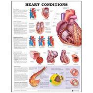 Heart Conditions edito da Anatomical Chart Co.