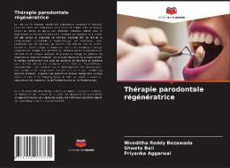 Thérapie parodontale régénératrice di Niveditha Reddy Bezawada, Shweta Bali, Priyanka Aggarwal edito da Editions Notre Savoir