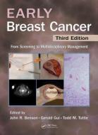 Early Breast Cancer edito da Taylor & Francis Ltd